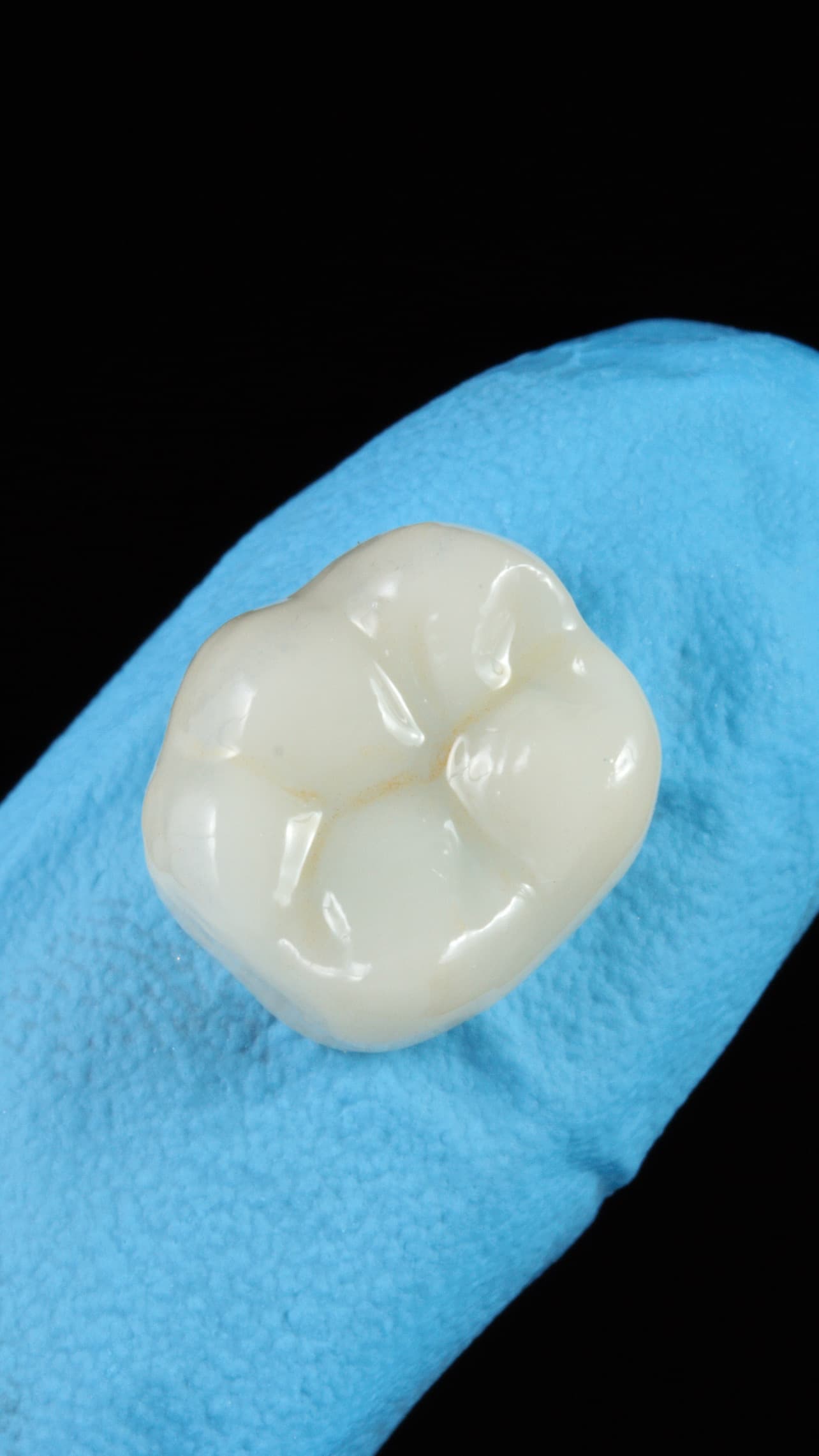 Reabilitação com Coroa