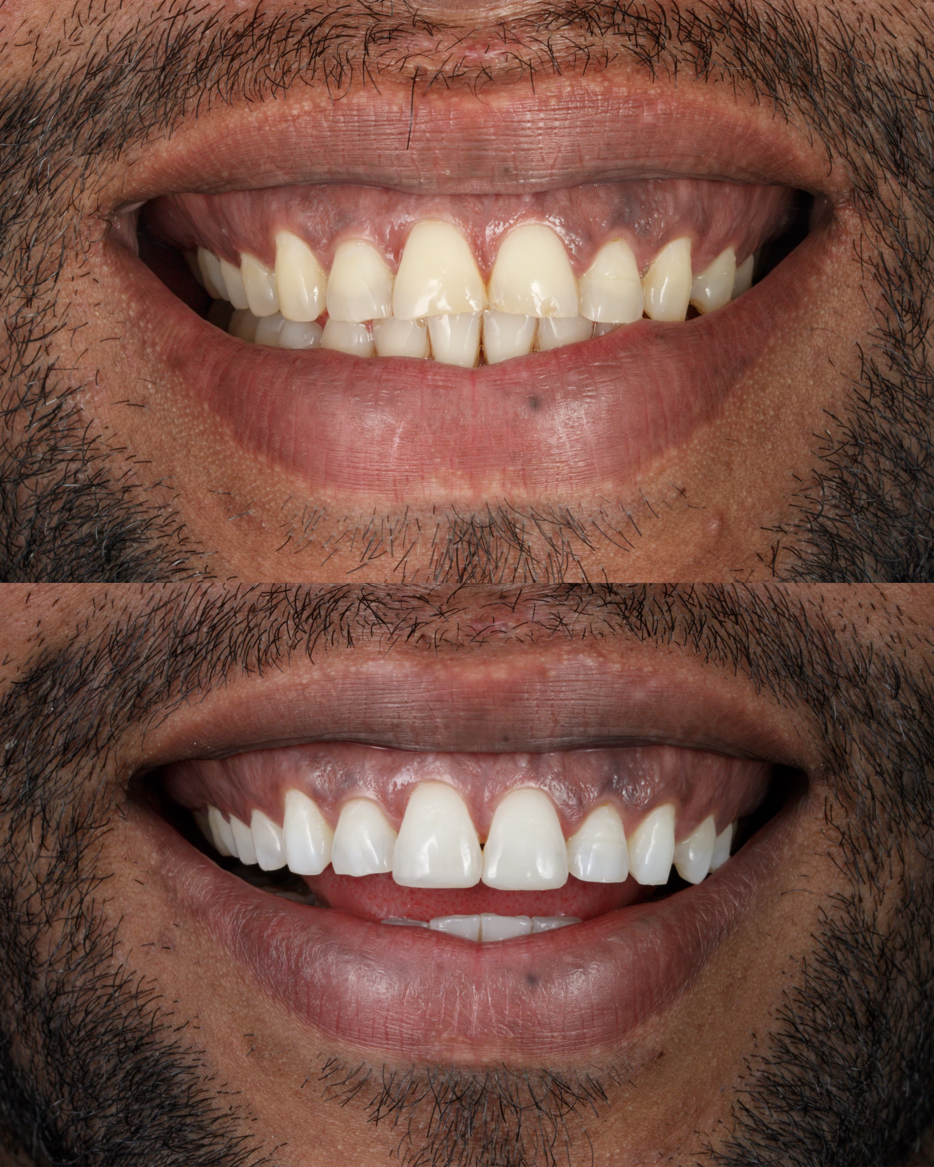 Planejamento Digital 3D