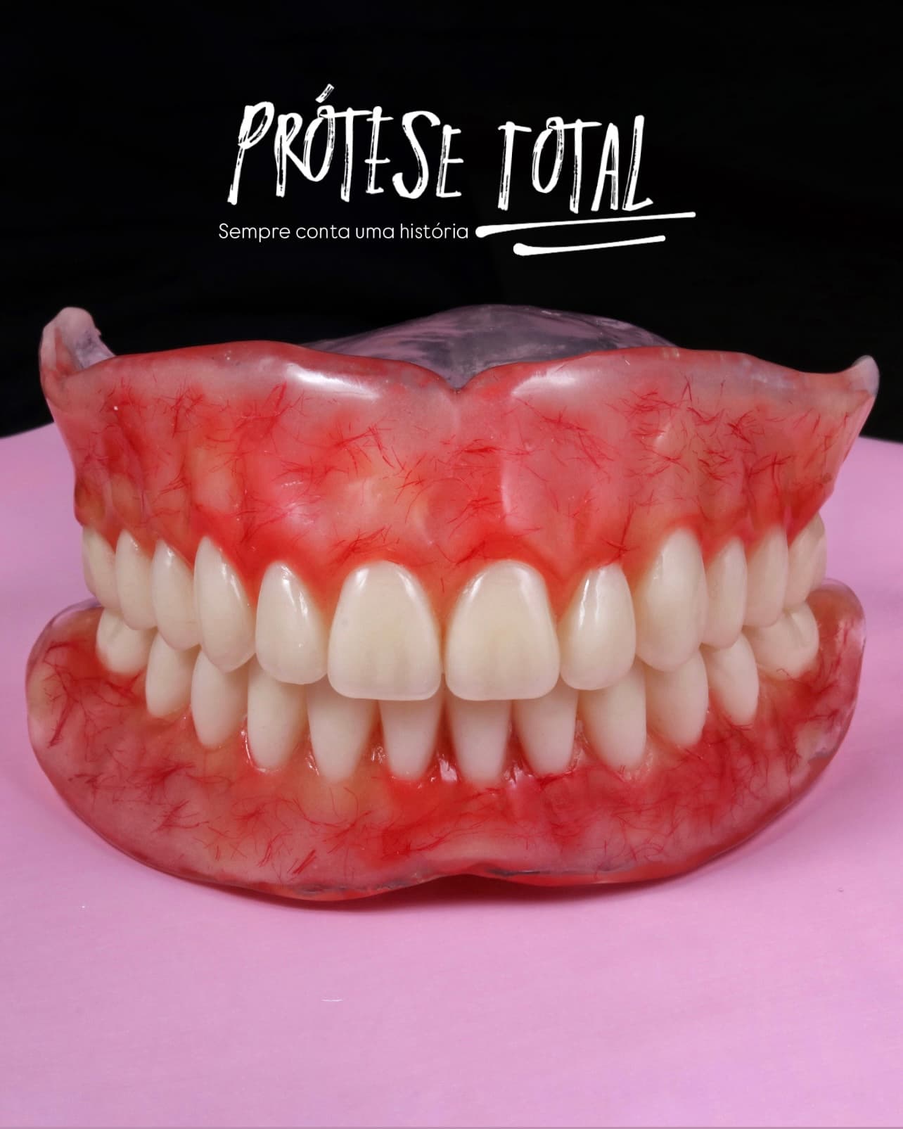 Prótese Total Caracterizada