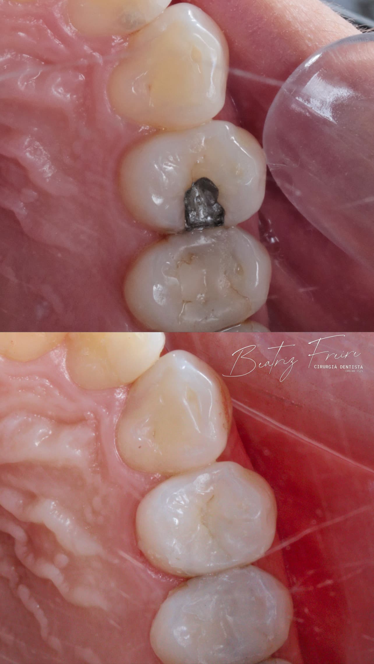 Restauração Estética