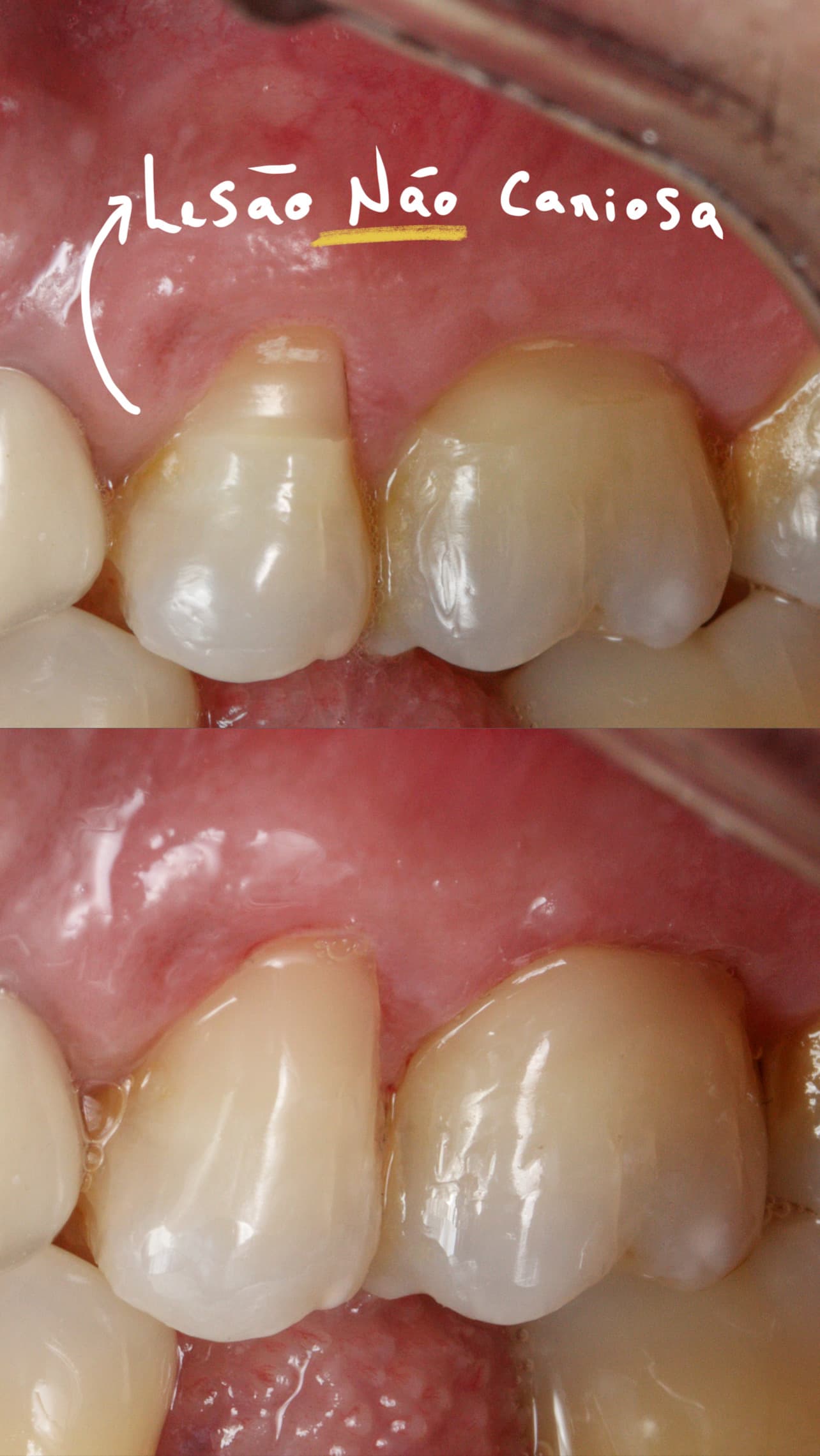 Restauração Estética - Foto 3